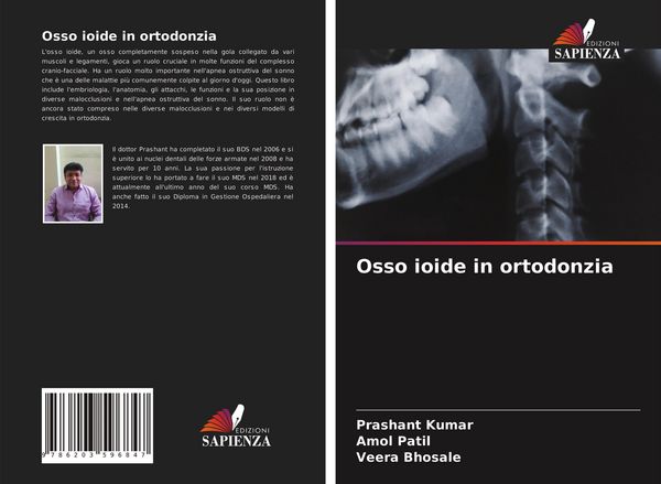 Produktbild: Osso ioide in ortodonzia