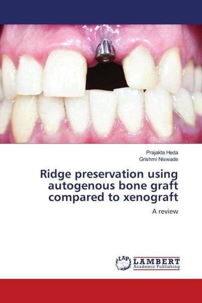 Produktbild: Ridge preservation using autogenous bone graft compared to xenograft
