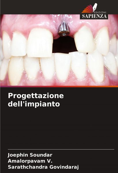 Produktbild: Progettazione dell'impianto