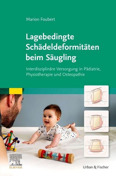 Produktbild: Lagebedingte Sch&auml;deldeformit&auml;ten beim S&auml;ugling