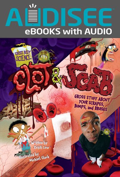 Produktbild: Clot & Scab
