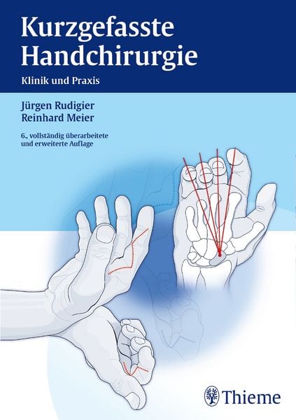 Produktbild: Kurzgefasste Handchirurgie