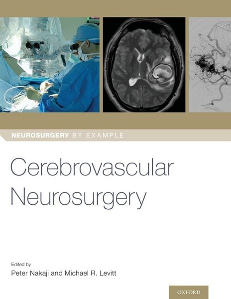 Produktbild: Cerebrovascular Neurosurgery