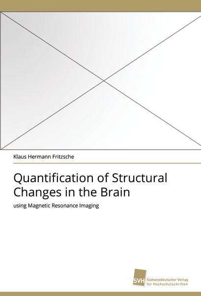 Produktbild: Quantification of Structural Changes in the Brain