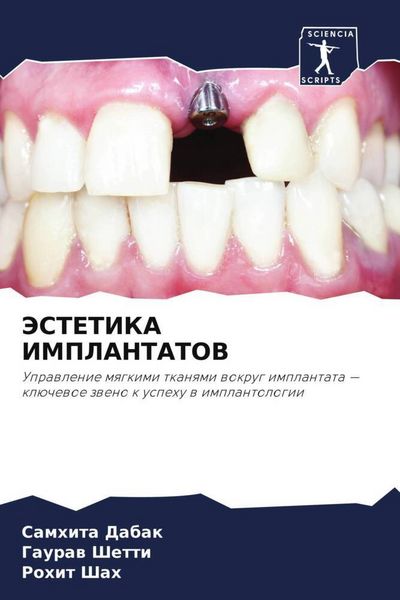 Produktbild: JeSTETIKA IMPLANTATOV
