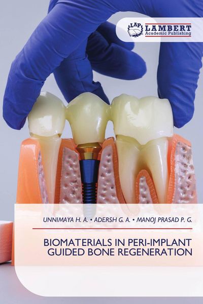 Produktbild: BIOMATERIALS IN PERI-IMPLANT GUIDED BONE REGENERATION
