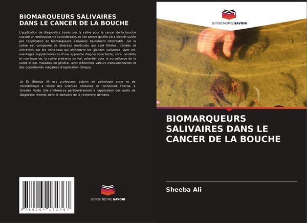 Produktbild: Biomarqueurs Salivaires Dans Le Cancer De La Bouche