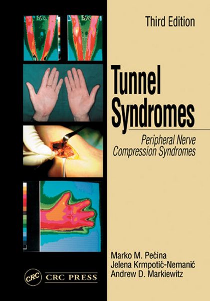 Produktbild: Tunnel Syndromes