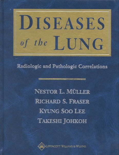 Produktbild: Diseases of the Lung: Radiologic and Pathologic Correlations