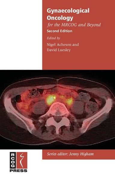 Produktbild: Gynaecological Oncology for the MRCOG and Beyond