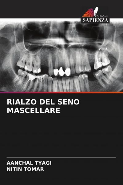 Produktbild: Rialzo Del Seno Mascellare