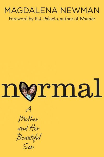 Produktbild: Normal