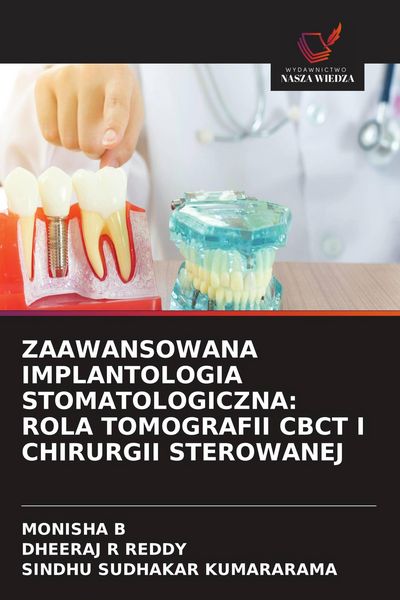 Produktbild: ZAAWANSOWANA IMPLANTOLOGIA STOMATOLOGICZNA: ROLA TOMOGRAFII CBCT I CHIRURGII STEROWANEJ