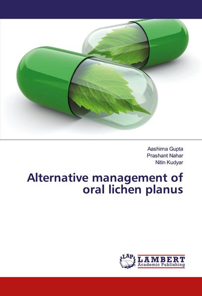 Produktbild: Alternative management of oral lichen planus