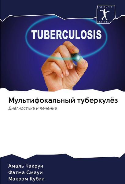 Produktbild: Mul'tifokal'nyj tuberkul&ouml;z