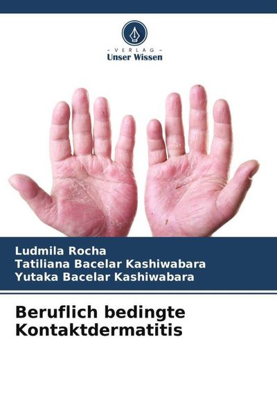 Produktbild: Beruflich bedingte Kontaktdermatitis