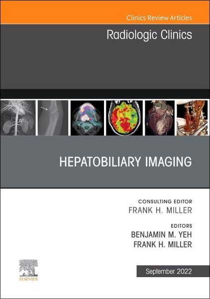 Produktbild: Hepatobiliary Imaging, an Issue of Radiologic Clinics of North America