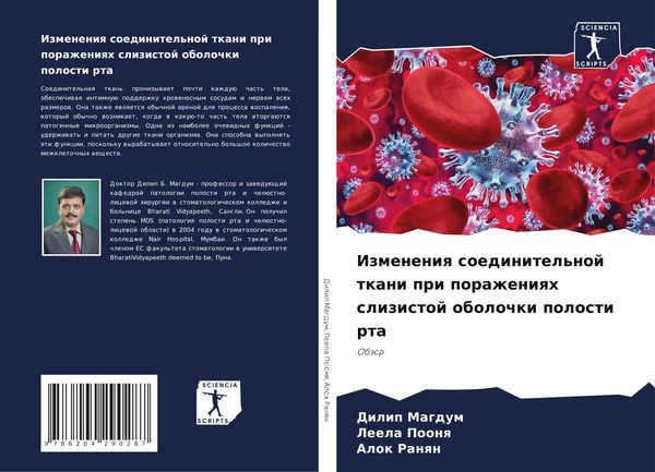 Produktbild: Izmeneniq soedinitel'noj tkani pri porazheniqh slizistoj obolochki polosti rta