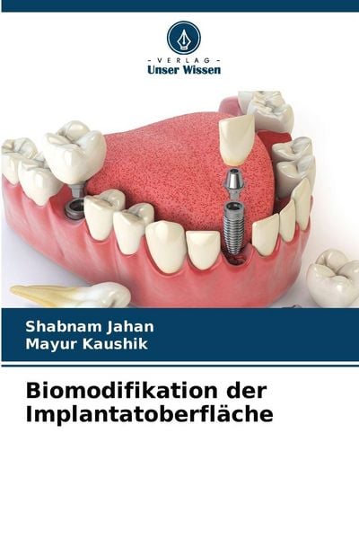 Produktbild: Biomodifikation der Implantatoberfl&auml;che