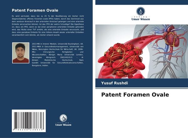 Patent Foramen Ovale, Taschenbuch von Yusuf Rushdi, Verlag Unser Wissen, 9786208238636