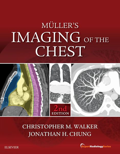 Produktbild: Muller's Imaging of the Chest E-Book