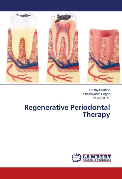 Produktbild: Regenerative Periodontal Therapy