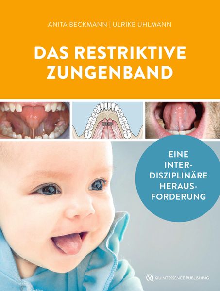Produktbild: Das restriktive Zungenband