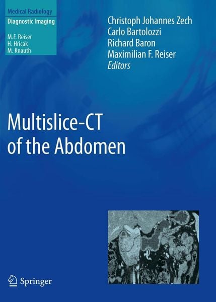 Produktbild: Multislice-CT of the Abdomen