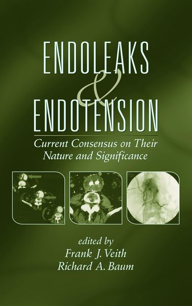 Produktbild: Endoleaks and Endotension
