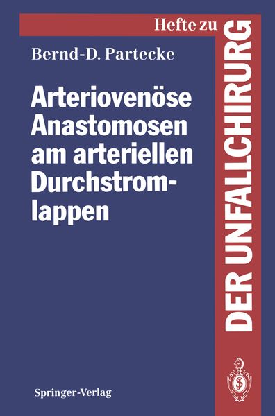 Arteriovenöse Anastomosen am arteriellen Durchstromlappen, Taschenbuch von Bernd-Dietmar Partecke, Springer Berlin, 9783540562306