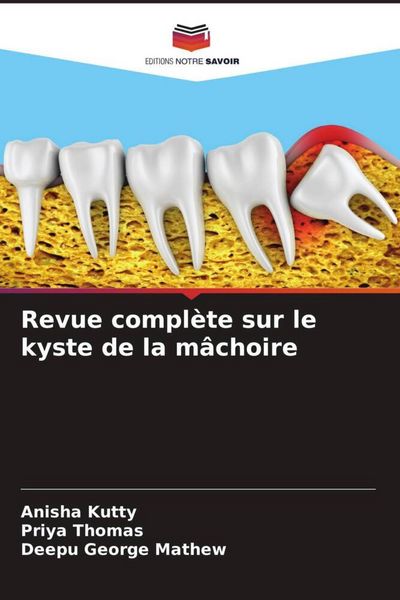 Produktbild: Revue compl&egrave;te sur le kyste de la m&acirc;choire