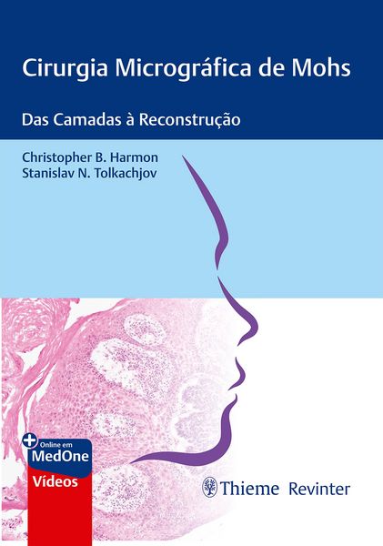 Produktbild: Cirurgia Microgr&aacute;fica de Mohs