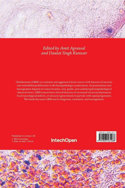 Produktbild: Glioblastoma