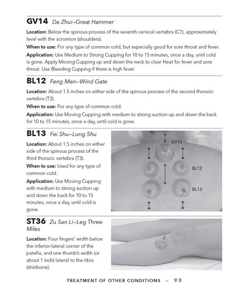 Produktbild: Cupping Therapy for Muscles and Joints