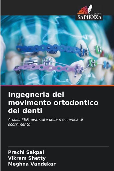 Produktbild: Ingegneria del movimento ortodontico dei denti