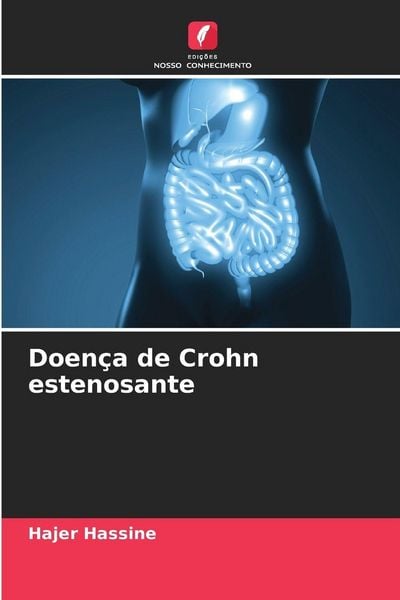 Produktbild: Doen&ccedil;a de Crohn estenosante