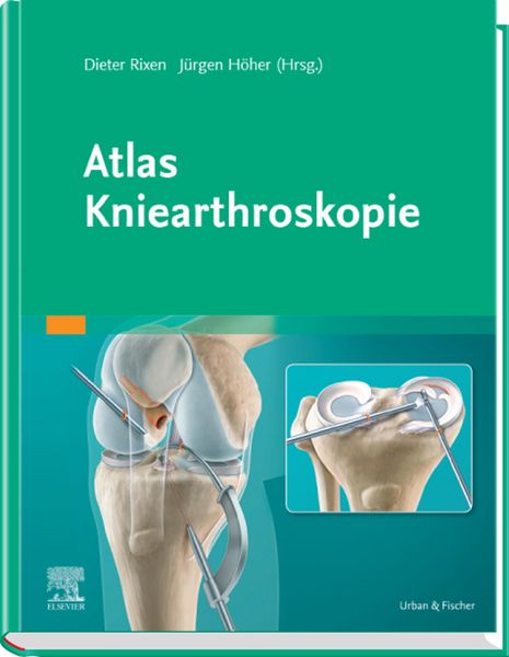 Produktbild: Atlas Kniearthroskopie