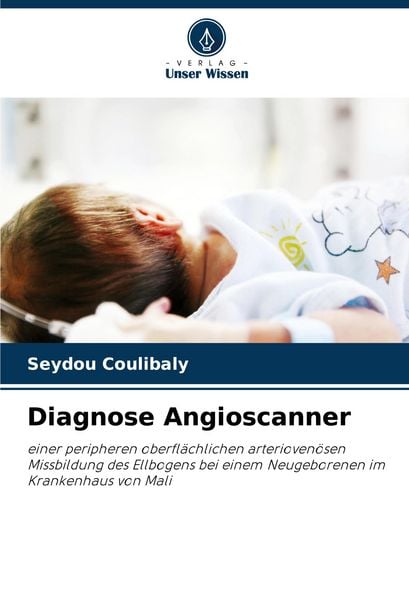 Diagnose Angioscanner, Taschenbuch von Seydou Coulibaly, Verlag Unser Wissen, 9786208024093