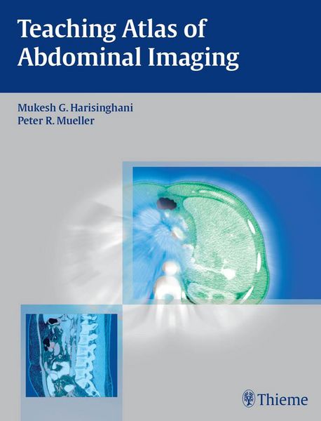 Produktbild: Teaching Atlas of Abdominal Imaging