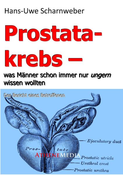 Produktbild: Prostatakrebs