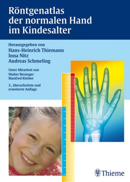 Produktbild: R&ouml;ntgenatlas der normalen Hand im Kindesalter