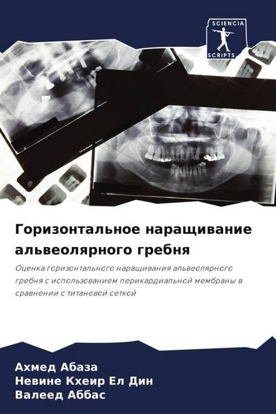 Produktbild: Gorizontal'noe naraschiwanie al'weolqrnogo grebnq