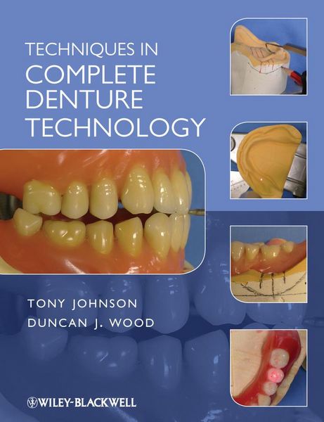 Produktbild: Techniques in Complete Denture Technology