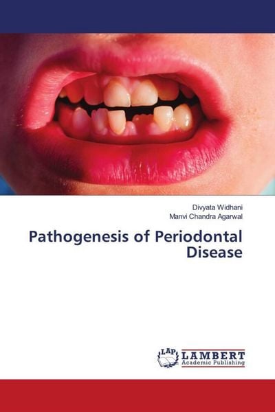 Produktbild: Pathogenesis of Periodontal Disease