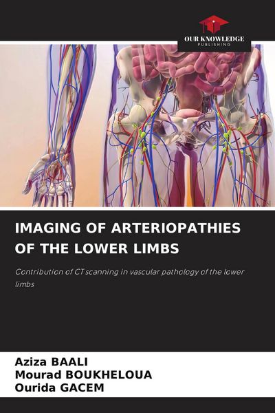 Produktbild: Imaging Of Arteriopathies Of The Lower Limbs
