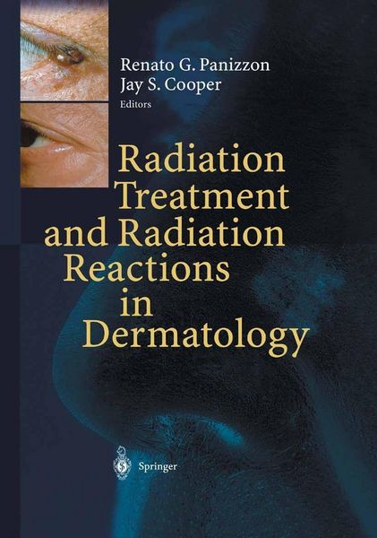 Produktbild: Radiation Treatment and Radiation Reactions in Dermatology