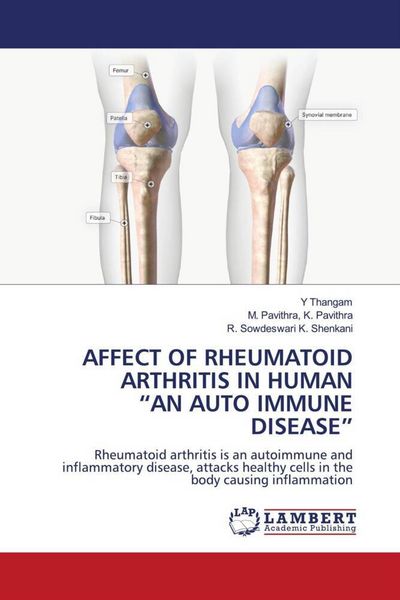 Produktbild: Affect Of Rheumatoid Arthritis in Human "an Auto Immune Disease"