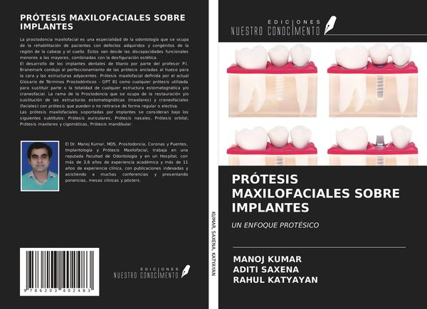 Produktbild: Pr&oacute;tesis Maxilofaciales Sobre Implantes