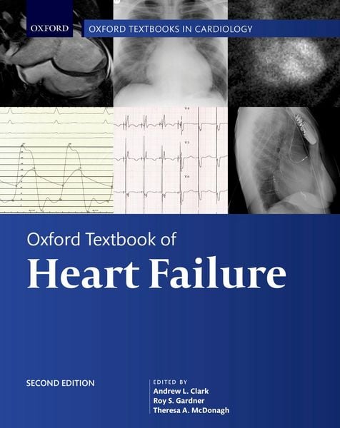 Produktbild: Oxford Textbook of Heart Failure