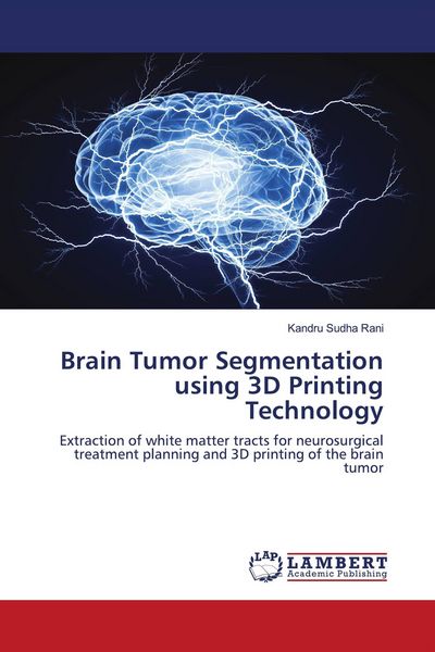 Produktbild: Brain Tumor Segmentation using 3D Printing Technology